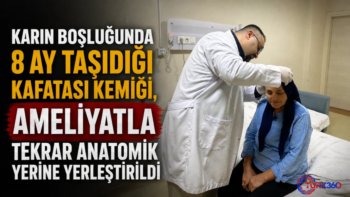 Karın boşluğunda 8 ay taşıdığı kafatası kemiği, ameliyatla tekrar anatomik yerine yerleştirildi 