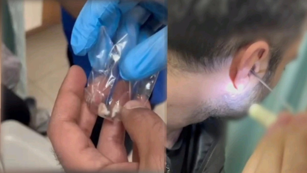 Polisin Dikkatinden Ka&ccedil;madı: Kulağına Gizlediği Uyuşturucuyla Yakalandı 