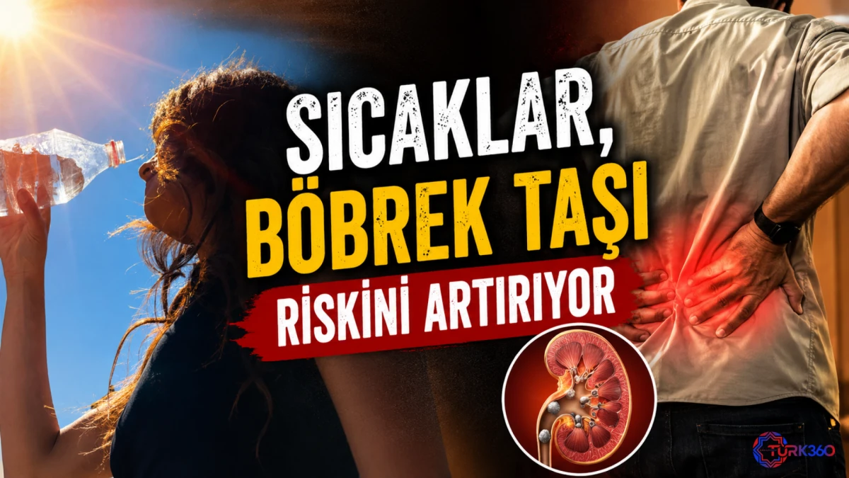 Sıcaklar, b&ouml;brek taşı riskini artırıyor 